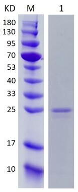 12% SDS-PAGE analysis profiles of purified His-RPA2 (CBB stained).